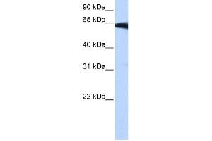 WB Suggested Anti-PIGW Antibody Titration:  0. (PIGW Antikörper  (Middle Region))