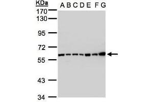 WB Image Sample(30 ug whole cell lysate) A: 293T B: A431 , C: H1299 D: HeLa S3 , E: Hep G2 , F: MOLT4 , G: Raji , 7. (Complement C2 Antikörper)