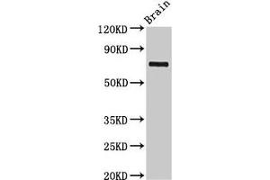 Western Blot Positive WB detected in: Rat brain tissue All lanes: L3MBTL4 antibody at 3 μg/mL Secondary Goat polyclonal to rabbit IgG at 1/50000 dilution Predicted band size: 72, 62 kDa Observed band size: 72 kDa (L3MBTL4 Antikörper  (AA 1-270))