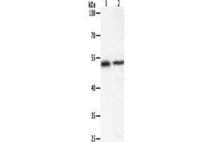 Gel: 10 % SDS-PAGE, Lysate: 40 μg, Lane 1-2: Human liver cancer tissue, 293T cells, Primary antibody: ABIN7192602(SOX1 Antibody) at dilution 1/400, Secondary antibody: Goat anti rabbit IgG at 1/8000 dilution, Exposure time: 20 seconds (SOX1 Antikörper)