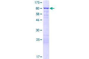 EPS8-Like 3 Protein (EPS8L3) (AA 1-594) (GST tag)