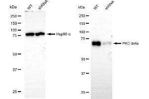 Western blotting analysis using PKC delta antibody (ABIN7799995).