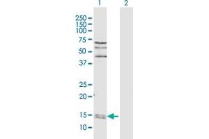 Western Blot analysis of PPIA expression in transfected 293T cell line by PPIA MaxPab polyclonal antibody. (PPIA Antikörper  (AA 1-165))