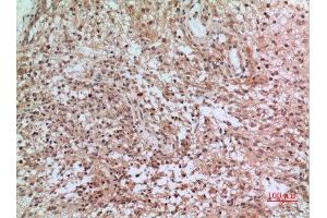 Immunohistochemistry (IHC) analysis of paraffin-embedded Human Brain, antibody was diluted at 1:100. (CD3D Antikörper  (Internal Region))
