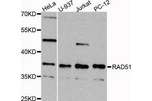 Western blot analysis of extracts of various cell lines, using RAD51 antibody (ABIN5973699) at 1/1000 dilution. (RAD51 Antikörper)