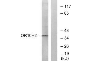 Western blot analysis of extracts from A549 cells, using OR10H2 antibody. (OR10H2 Antikörper  (C-Term))