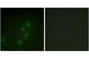 Immunofluorescence analysis of HeLa cells, using MYF5 (Ab-49) Antibody. (MYF5 Antikörper  (AA 21-70))