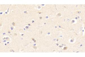 Immunohistochemistry (IHC) image for anti-Cholinergic Receptor, Nicotinic, beta 2 (Neuronal) (CHRNB2) (AA 86-244) antibody (ABIN7433732)