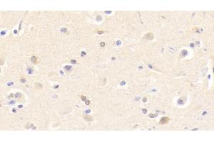 Detection of CHRNb2 in Human Cerebrum Tissue using Polyclonal Antibody to Cholinergic Receptor, Nicotinic, Beta 2 (CHRNb2) (CHRNB2 Antikörper  (AA 86-244))