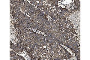 IHC analysis of NSF using anti-NSF antibody (ABIN7601630). (NSF Antikörper  (AA 4-636))