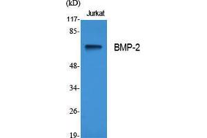 Western Blot (WB) analysis of specific cells using BMP-2 Polyclonal Antibody. (BMP2 Antikörper  (Internal Region))