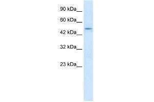 WB Suggested Anti-ZNF651 Antibody Titration:  2. (ZBTB47 Antikörper  (N-Term))