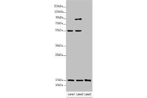 Western blot All lanes: UXT antibody at 3. (UXT Antikörper  (AA 1-157))
