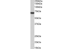 Western Blotting (WB) image for anti-Myotubularin 1 (MTM1) (C-Term) antibody (ABIN184636)