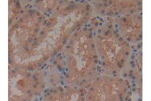 DAB staining on IHC-P; Samples: Human Kidney Tissue (CD235a/GYPA Antikörper  (AA 20-91))
