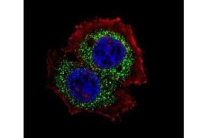 Fluorescent confocal image of MCF-7 cell stained with Estrogen Receptor antibody at 1:25. (Estrogen Receptor alpha Antikörper  (Isoform 4))