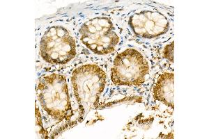 Immunohistochemistry of paraffin-embedded rat colon using [KO Validated] NADPH oxidase 4 (NOX4) Rabbit pAb (ABIN6128328, ABIN6144752, ABIN6144753 and ABIN6215143) at dilution of 1:100 (40x lens). (NADPH Oxidase 4 Antikörper  (AA 328-578))