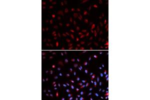 Immunofluorescence analysis of U2OS cells using ERCC1 antibody. (ERCC1 Antikörper  (AA 1-323))