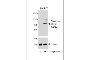 Western blot analysis of lysates from MCF-7 cell line, untreated or treated with Calyculin A, 100nM, using (ABIN6241058 and ABIN6578964) (upper) or Tubulin (lower). (SSH3 Antikörper  (pSer37))