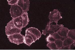 Immunofluorescent staining of A431 cells with anti-fyn antibody. (FYN Antikörper  (AA 1-132))