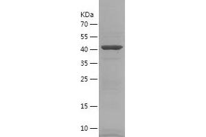 IGSF11 Protein (AA 24-241) (His-IF2DI Tag)