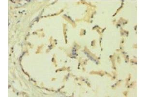 Immunohistochemistry of paraffin-embedded human plastate using TIMP1 Antibody at a dilution of 1:100. (TIMP1 Antikörper  (AA 24-207))