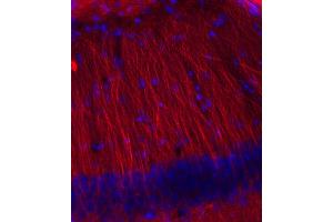 Immunohistochemistry (IHC) image for anti-Tubulin, beta 3 (TUBB3) (AA 443-450) antibody (ABIN1742554) (TUBB3 Antikörper  (AA 443-450))