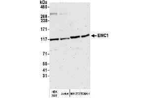 anti-KIAA0090 (KIAA0090) (AA 1-50) antibody