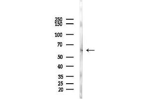 Western blot analysis of lysates from A2780 cells(UV,30 min treatment), using Phospho-RIP3/RIPK3 (Thr187) Antibody at 1/1000 dilution.