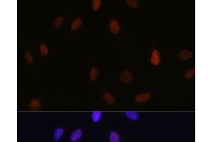 Immunofluorescence analysis of U-2 OS cells using MonoMethyl-Histone H3-K14 Polyclonal Antibody at dilution of 1:100 (40x lens). (Histone 3 Antikörper  (meLys14))