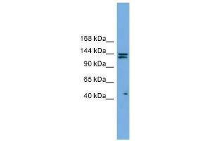 IARS antibody used at 1 ug/ml to detect target protein. (IARS Antikörper  (Middle Region))