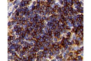 Immunohistochemistry analysis of paraffin-embedded Mouse spleen using CD192 Polyclonal Antibody at dilution of 1:300. (CCR2 Antikörper)