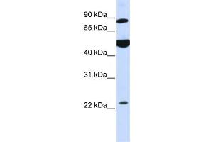 Western Blotting (WB) image for anti-Mannosyl-Oligosaccharide Glucosidase (MOGS) antibody (ABIN2459038)