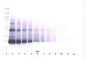 Image no. 3 for anti-Interferon, beta 1, Fibroblast (IFNB1) antibody (ABIN464940) (IFNB1 Antikörper)