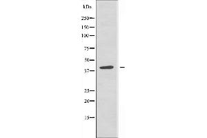 Western blot analysis of extracts from Jurkat cells, using RAD51L3 antibody. (RAD51D Antikörper  (C-Term))