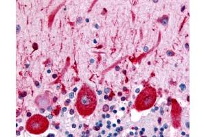 Immunohistochemistry (IHC) image for anti-Cadherin EGF LAG Seven Pass G-Type Receptor 3 (CELSR3) (N-Term) antibody (ABIN1048433)