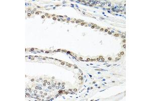 Immunohistochemistry of paraffin-embedded human prostate using ELAVL1 antibody. (ELAVL1 Antikörper  (AA 1-100))