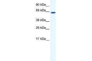 Western Blotting (WB) image for anti-TATA Box Binding Protein (TBP)-Associated Factor, RNA Polymerase I, B, 63kDa (TAF1B) (C-Term) antibody (ABIN2780030)