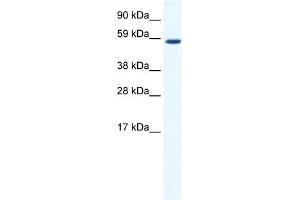 WB Suggested Anti-TAF1B Antibody Titration:  1. (TAF1B Antikörper  (C-Term))