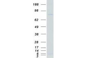 Western Blotting (WB) image for Tousled-Like Kinase 1 (TLK1) (Transcript Variant 1) protein (Myc-DYKDDDDK Tag) (ABIN2733815)