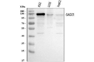 Western blot analysis of SAGE1 using anti-SAGE1 antibody (ABIN7602679). (SAGE1 Antikörper  (AA 94-633))