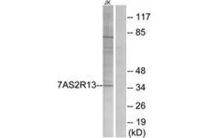 Western blot analysis of extracts from Jurkat cells, using TAS2R13 Antibody. (TAS2R13 Antikörper  (AA 123-172))