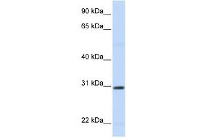 WB Suggested Anti-STC1 Antibody Titration:  0. (Stanniocalcin 1 Antikörper  (N-Term))