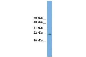 Human COLO205; WB Suggested Anti-PPIL3 Antibody Titration: 0. (PPIL3 Antikörper  (Middle Region))