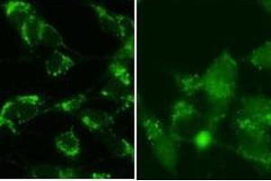 Immunocytochemistry (ICC) image for anti-Microtubule-Associated Protein 1 Light Chain 3 beta (MAP1LC3B) (AA 89-122), (cleaved) antibody (ABIN388484)