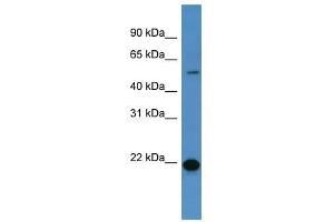 Western Blot showing CEACAM3 antibody used at a concentration of 1-2 ug/ml to detect its target protein. (CEACAM3 Antikörper  (C-Term))