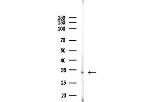 anti-Inhibitor of Growth Family, Member 2 (ING2) (C-Term) antibody