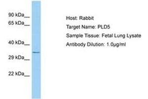 Image no. 1 for anti-Phospholipase D Family, Member 5 (PLD5) (AA 189-238) antibody (ABIN6750223) (PLD5 Antikörper  (AA 189-238))