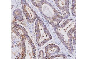IHC analysis of Claudin 3/CLDN3 using anti-Claudin 3/CLDN3 antibody (ABIN7599625). (Claudin 3 Antikörper  (AA 101-220))