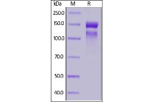 Human ITGA10&ITGB1 Heterodimer Protein, His Tag&Tag Free on  under reducing (R) condition.